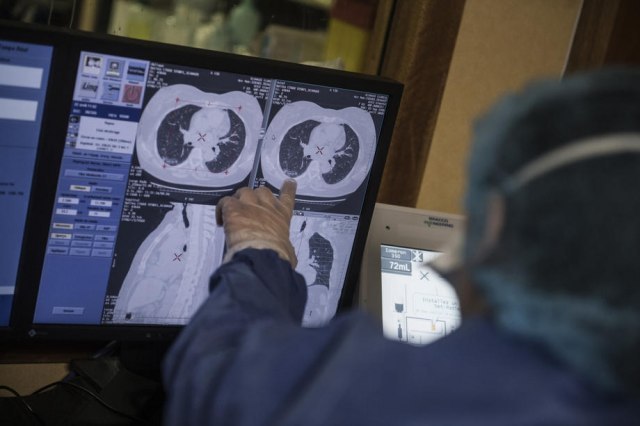 Da li krvna slika može da otkrije tumor na mozgu? Odgovor će vas iznenaditi